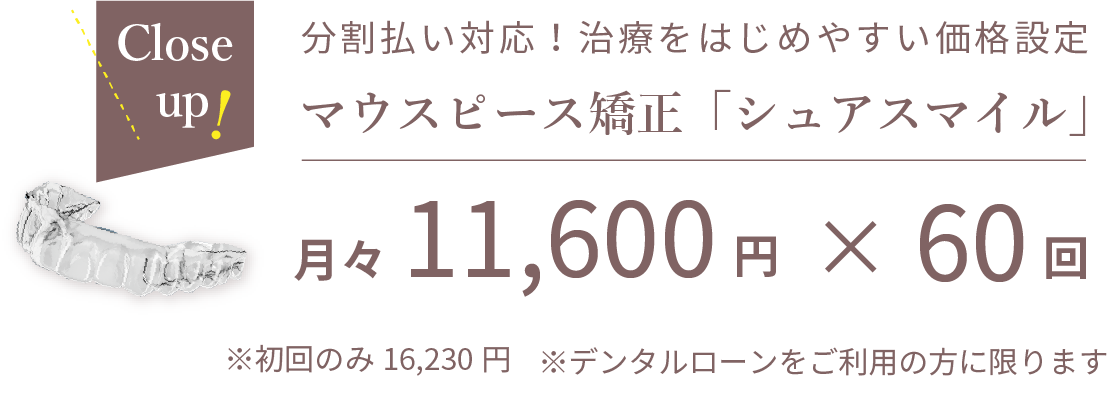 シュアスマイルの分割払い