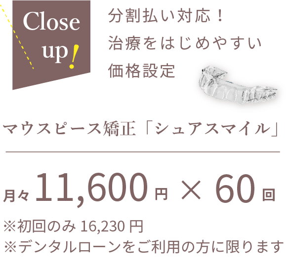 シュアスマイルの分割払い