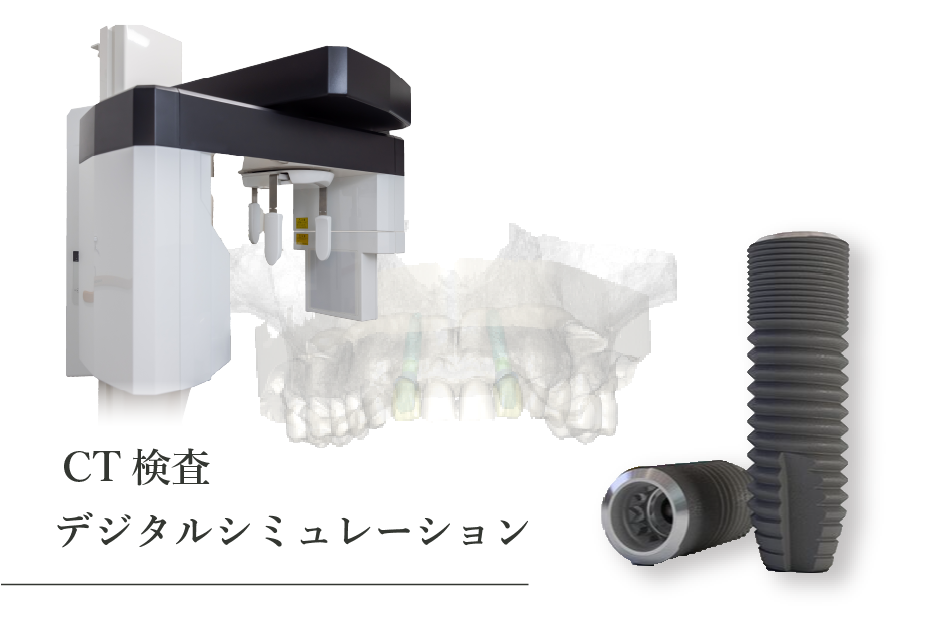 CT検査でデジタルシミュレーション装置